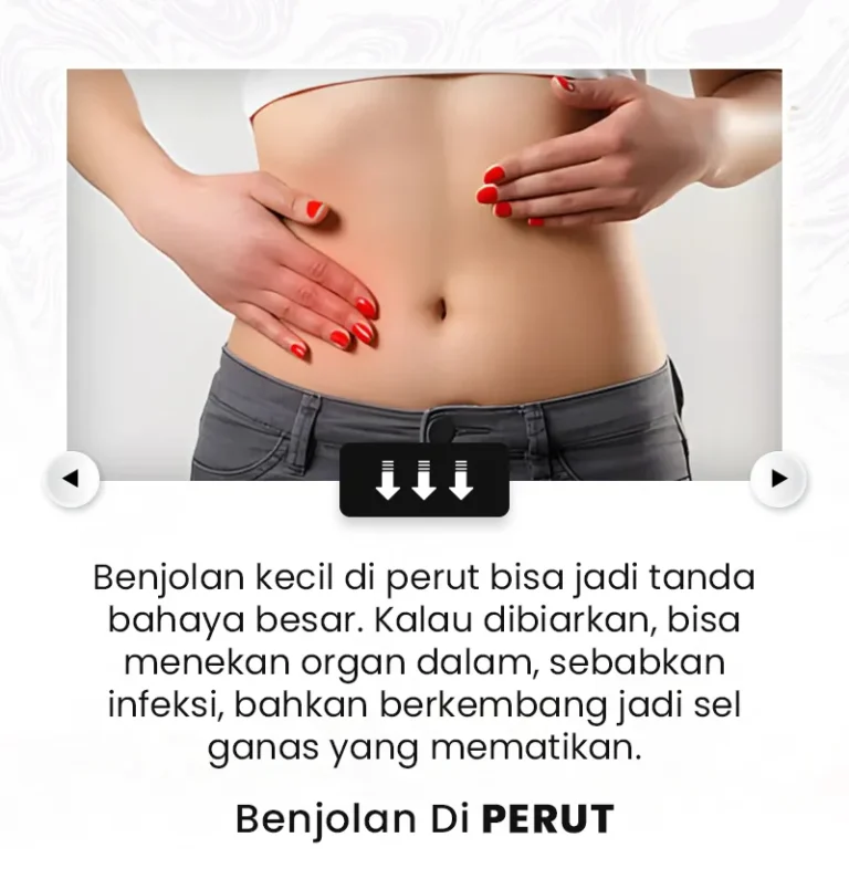 benjolan